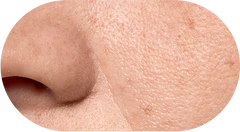 Textured Skin