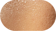 Oily Skin