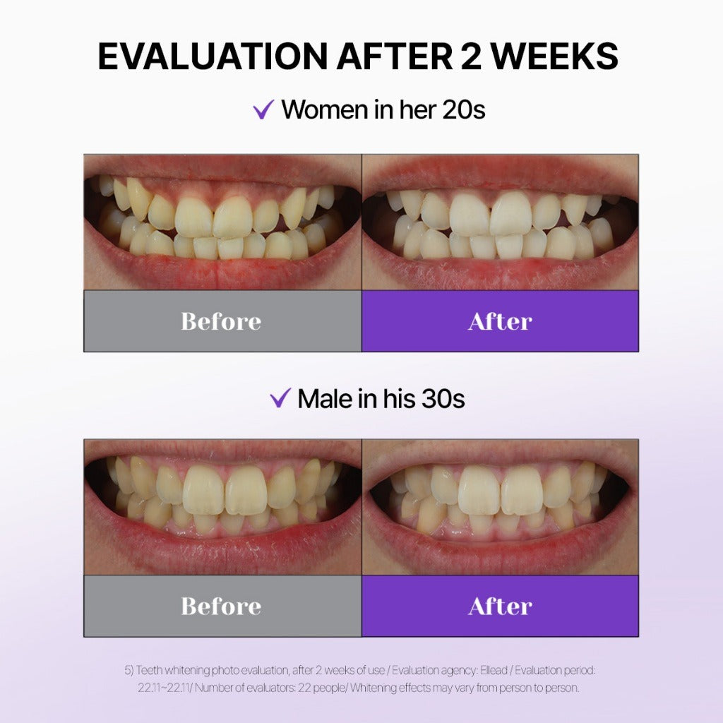 Euthymol Original Whitening Purple Corrector Toothpaste