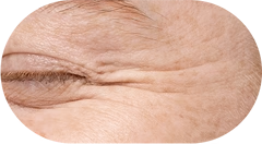 Fine Lines